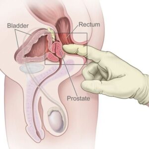 Prostate Massager - FRISKY BUSINESS SG